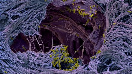 Das pathogene Bakterium Pseudomonas aeruginosa durchdringt das respiratorische Epithel eines menschlichen Lungenmikrogewebemodells.