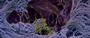 Das pathogene Bakterium Pseudomonas aeruginosa durchdringt das respiratorische Epithel eines menschlichen Lungenmikrogewebemodells.