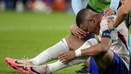 Kylian Mbappe aus Frankreich blutet nach einem Zusammenstoß aus der Nase. 
