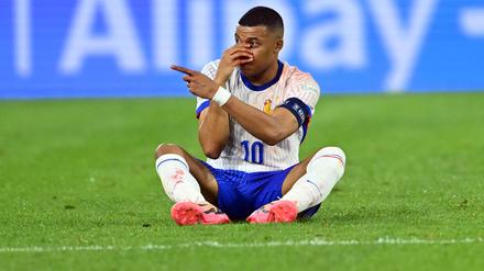 Kylian Mbappé lässt sich von einem Nasenbeinbruch nicht aufhalten.