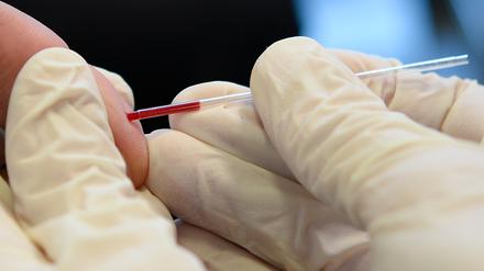 Ein Arzt nimmt bei der Berliner Aidshilfe an dem Finger eines jungen Mannes Blut ab.