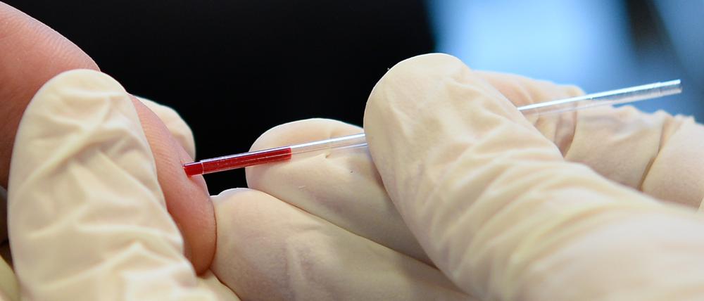 Ein Arzt nimmt bei der Berliner Aidshilfe an dem Finger eines jungen Mannes Blut ab.