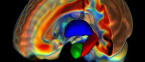 Hirnscan einer Frau mit blau hervorgehobenem Thalamus, der Amygdala (grün) und dem Hippocampus (rot).