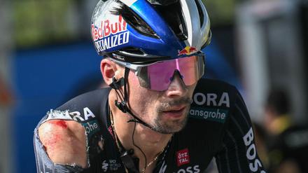Schwer gezeichnet. Bora-Topstar Primoz Roglic musste die Tour de France schon nach der 12. Etappe verletzt aufgeben.