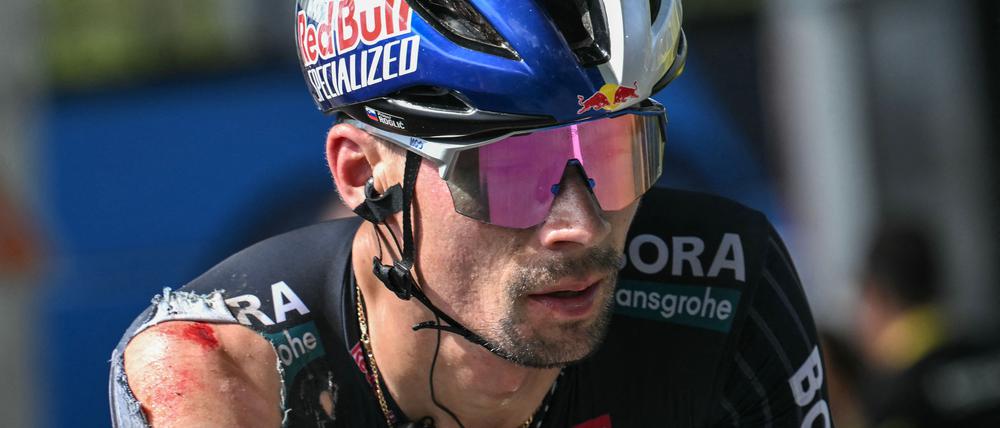 Schwer gezeichnet. Bora-Topstar Primoz Roglic musste die Tour de France schon nach der 12. Etappe verletzt aufgeben.