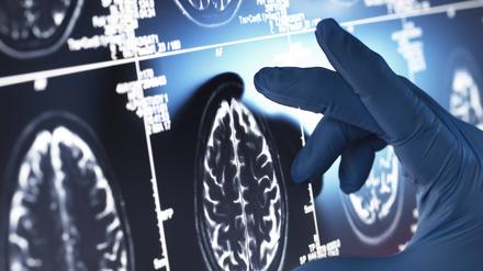Verschiedene Hirnscans von Menschen.