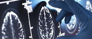 Verschiedene Hirnscans von Menschen.