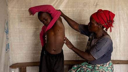 Eine Mutter in der Demokratischen Republik Kongo untersucht ihren Sohn nach einer Erkrankung mit Mpox.