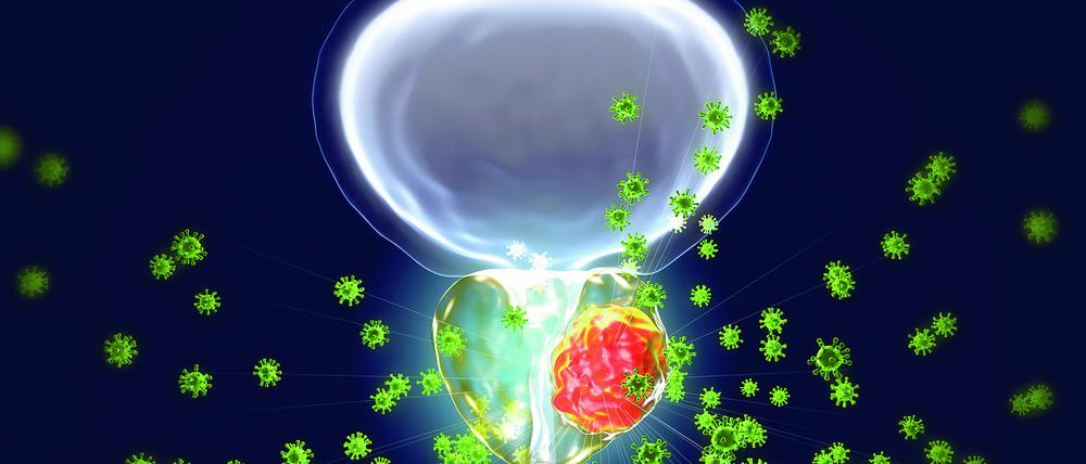 Bei fortgeschrittenem Tumor kommt es zu Problemen beim Wasserlassen, starken Schmerzen im Bauchraum oder Erektionsstörungen.