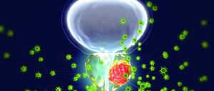 Bei fortgeschrittenem Tumor kommt es zu Problemen beim Wasserlassen, starken Schmerzen im Bauchraum oder Erektionsstörungen.