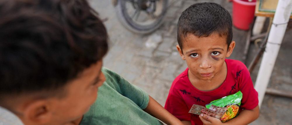 Mehr als 92.000 Menschen in Gaza sind durch den Krieg verletzt worden.
