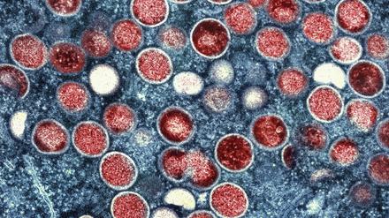Eine eingefärbte Mikroskopaufnahme von Mpox-Partikeln (rot) in einer infizierten Zelle (blau), die im Labor kultiviert wurde. 