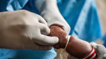 Die Weltgesundheitsorganisation (WHO) ist global im Einsatz, wie hier im Kongo. 