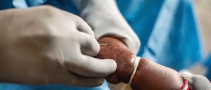 Die Weltgesundheitsorganisation (WHO) ist global im Einsatz, wie hier im Kongo. 