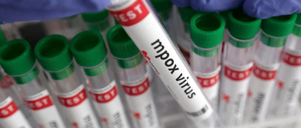 Ein Mpox-Test.