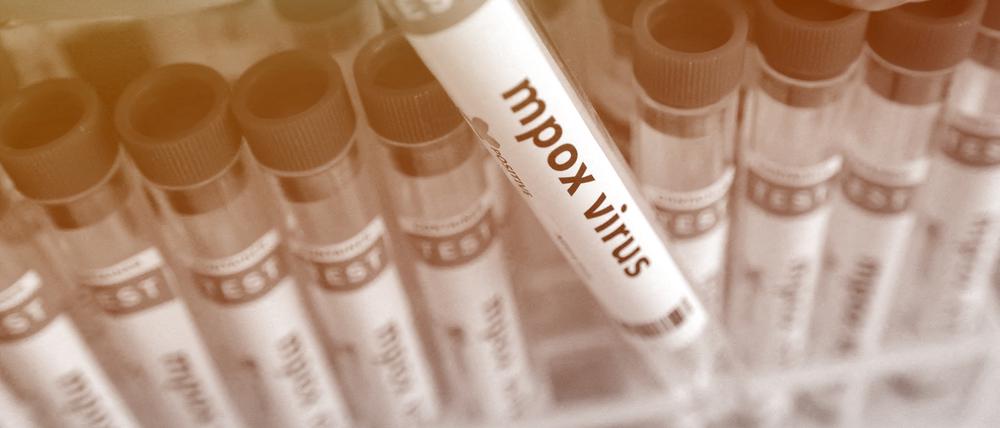 Bislang finden sich die meisten Proben mit dem Mpox-Virus in Afrika.   