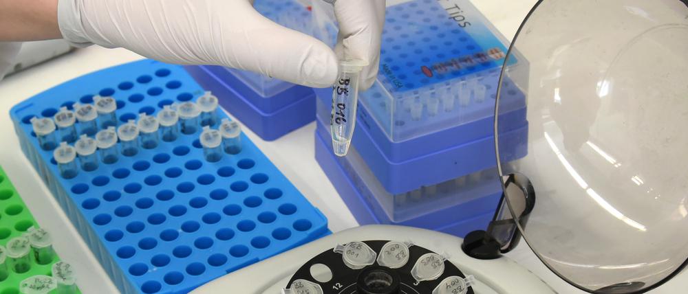 PCR-Tests im Labor. (Symbolbild)