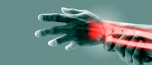 Osteoporose in Unterarm und Handgelenk. (Illustration)