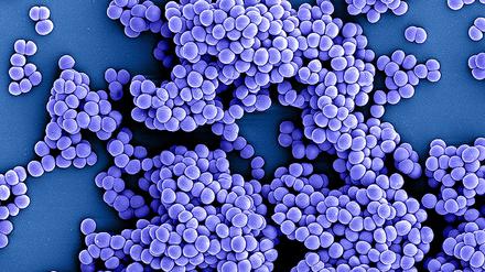 Staphylococcus-aureus-Bakterien haben im Jahr 2021 etwa 130.000 Todesfälle verursacht, mehr als doppelt so viele wie 1990.