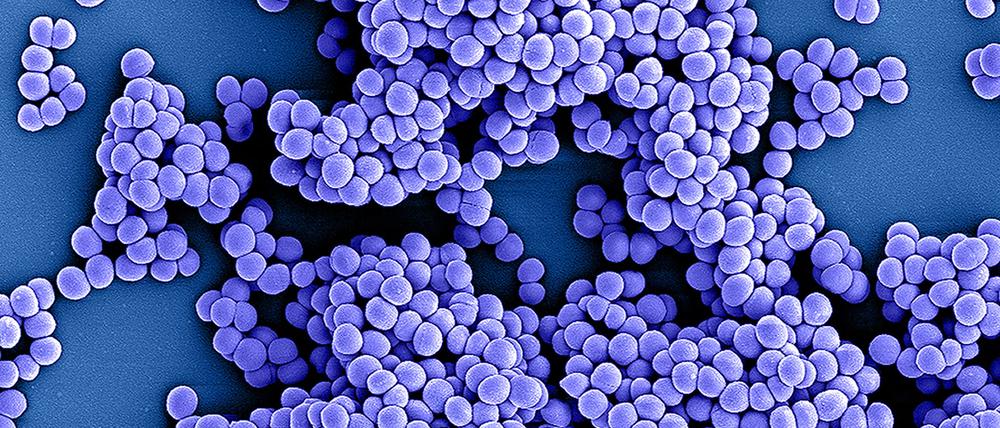 Staphylococcus-aureus-Bakterien haben im Jahr 2021 etwa 130.000 Todesfälle verursacht, mehr als doppelt so viele wie 1990.