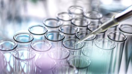 Eine Pipette über einer Vielzahl von Reagenzgläsern.