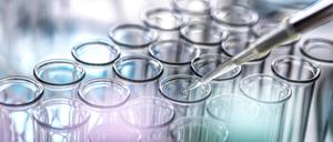 Eine Pipette über einer Vielzahl von Reagenzgläsern.