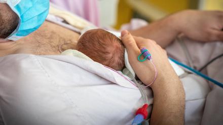 Extrem früh geborene Kinder überleben immer häufiger, haben aber oft lebenslang gesundheitliche Probleme.