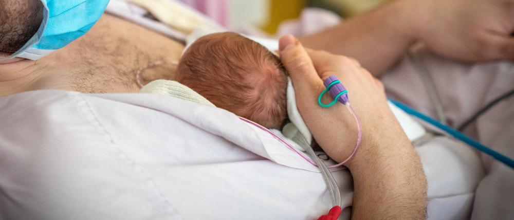Extrem früh geborene Kinder überleben immer häufiger, haben aber oft lebenslang gesundheitliche Probleme.