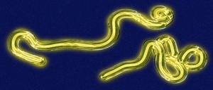 Das Marburg-Virus ist ein Verwandter des Ebola-Virus.