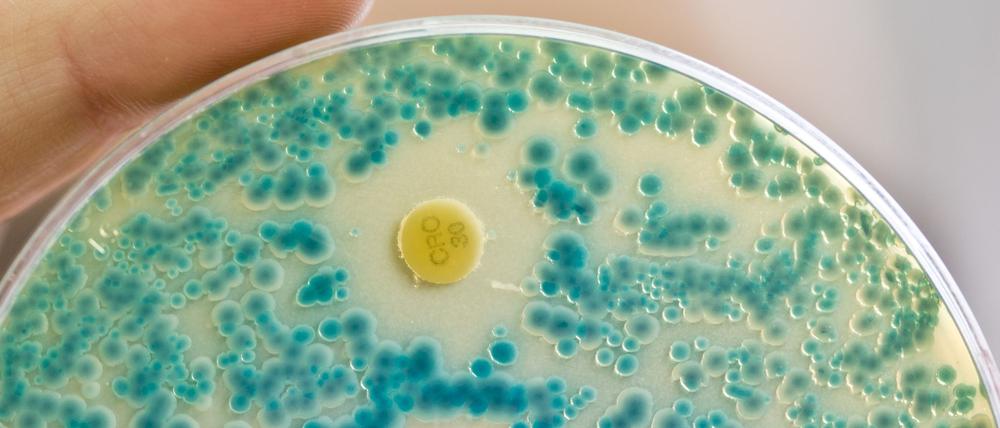 Indikatorkulturplatte zum Nachweis von resistenten Bakterien: Antibiotikaresistente Keime verursachen allein in der EU jährlich Zehntausende Todesfälle. (Symbolbild)