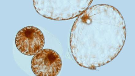 Die kleine und die große Form von Pyrocystis noctiluca kommt nur kurz nebeneinander vor.