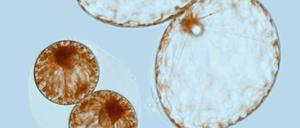 Die kleine und die große Form von Pyrocystis noctiluca kommt nur kurz nebeneinander vor.