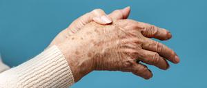 Die Schmerzen in den Gelenken können gleich heftig sein, doch die Ursachen von Gicht und Pseudo-Gicht sind unterschiedlich. (Symbolfoto)