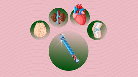 Schmerzfreies Knie, gesünderes Herz, stabilere Nieren: Ist der Wirkstoff in Abnehmspritzen wirklich so vielseitig, wie es scheint?