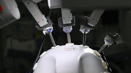 OP-Roboter, das klingt modern und nach fehlerfreier Operation. Immer mehr Kliniken schaffen sich die Maschinen an, weil das die Patienten erwarten.