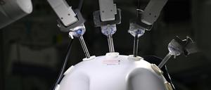 OP-Roboter, das klingt modern und nach fehlerfreier Operation. Immer mehr Kliniken schaffen sich die Maschinen an, weil das die Patienten erwarten.
