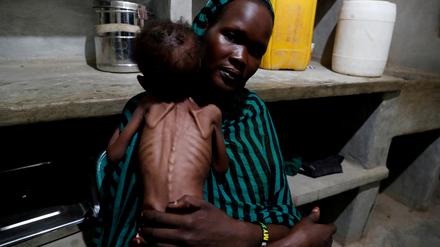 Unterernährung im Sudan.