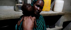 Unterernährung im Sudan.