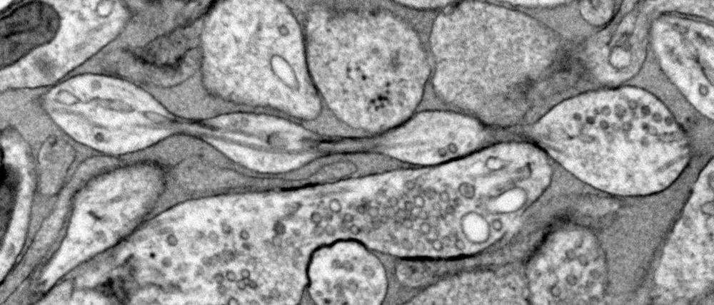 Mikroskopische Aufnahme eines Axons, das regelmäßige Verdickungen aufweist, die aussehen, als wären Perlen auf einer Schnur aufgefädelt.  