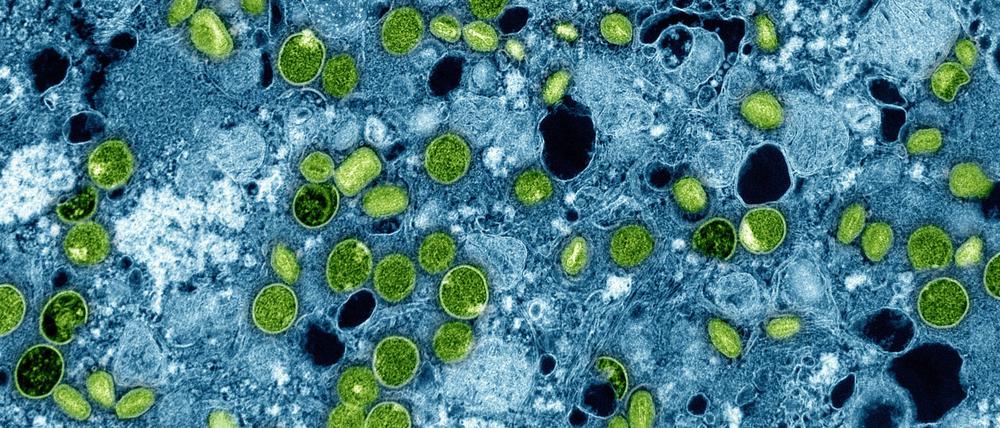 So sehen die Mpox-Viruspartikel unter dem Mikroskop aus. (Archivbild)