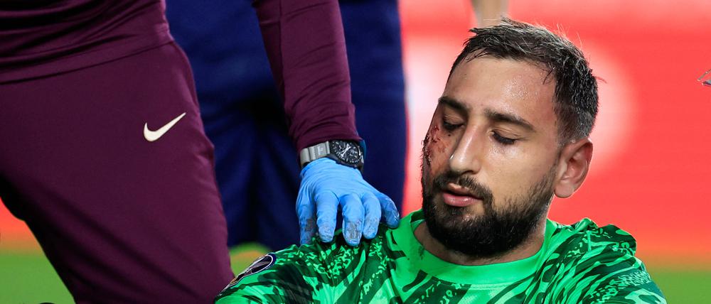 Gianluigi Donnarumma musste mit Verletzungen an der rechten Wange ausgewechselt werden.