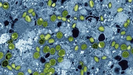 Diese kolorierte elektronenmikroskopische Aufnahme zeigt Mpox-Viruspartikel (grün), die sich in infizierten kultivierten Zellen (blau) befinden. Die Viruspartikel befinden sich in verschiedenen Reifestadien, was zu Unterschieden in der Form führt.