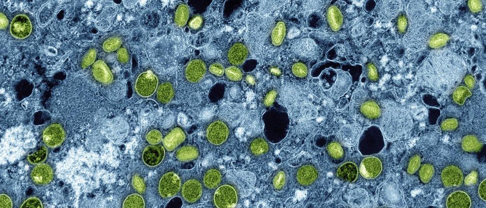 Diese kolorierte elektronenmikroskopische Aufnahme zeigt Mpox-Viruspartikel (grün), die sich in infizierten kultivierten Zellen (blau) befinden. Die Viruspartikel befinden sich in verschiedenen Reifestadien, was zu Unterschieden in der Form führt.
