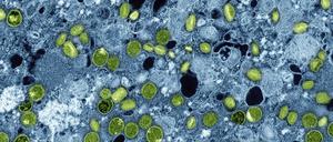 Diese kolorierte elektronenmikroskopische Aufnahme des National Institute of Allergy and Infectious Diseases aus dem Jahr 2024 zeigt Mpox-Viruspartikel (grün), die sich in infizierten kultivierten Zellen (blau) befinden.
