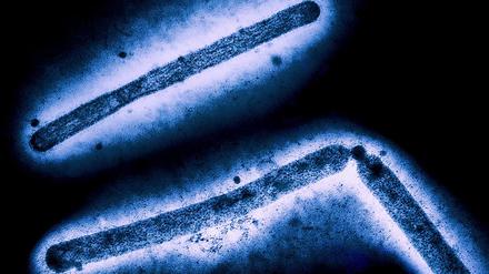 Dieses undatierte Handout-Foto, das am 22. November 2024 von der US-Gesundheitsbehörde CDC und dem US-Forschungszentrum National Institute of Allergy and Infectious Diseases (NIAID) veröffentlicht wurde, zeigt drei Influenza-A-(H5N1/Vogelgrippe)-Viruspartikel (stabförmig).