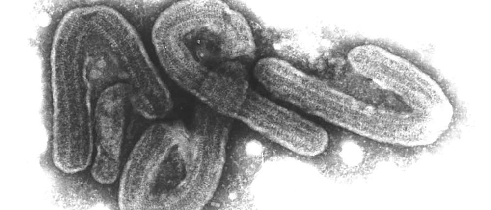 Eine elektronenmikroskopische Aufnahme des Marburg-Virus. (Archivbild)