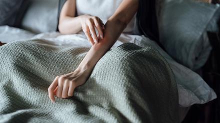 Rund zwei bis drei Millionen Deutsche sind von Psoriasis betroffen. 