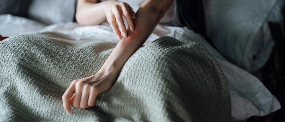 Rund zwei bis drei Millionen Deutsche sind von Psoriasis betroffen. 