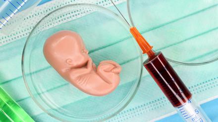 Manche Tests, vor allem die auf Erbkrankheiten, verlangen die schwere Entscheidung, ob Eltern das Ergebnis überhaupt wissen möchten. 