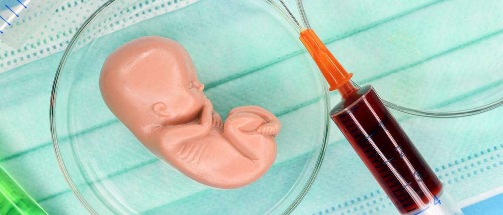 Manche Tests, vor allem die auf Erbkrankheiten, verlangen die schwere Entscheidung, ob Eltern das Ergebnis überhaupt wissen möchten. 